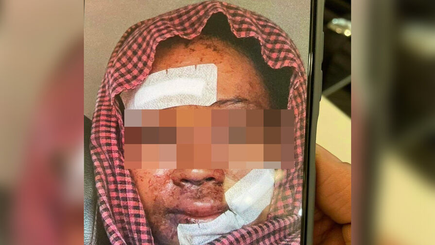 В Таиланде поляки напали на девушку из Камбоджи с ножом, молотком и кислотой