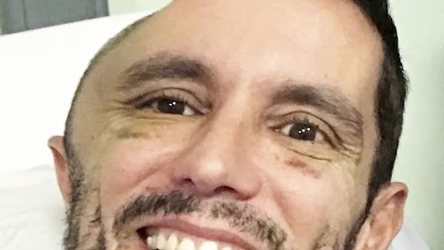 У мужчины удалили половину черепа после падения с лестницы в метро