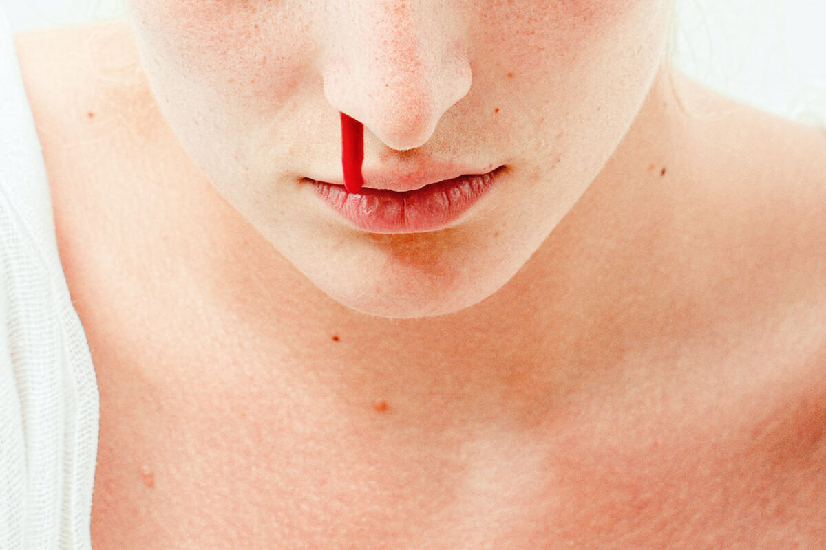Почему из носа идет кровь, как остановить кровотечение?
