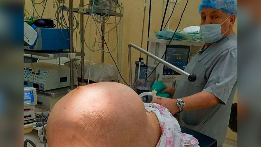 Новгородские врачи удалили женщине гигантскую опухоль яичника объемом 40 литров