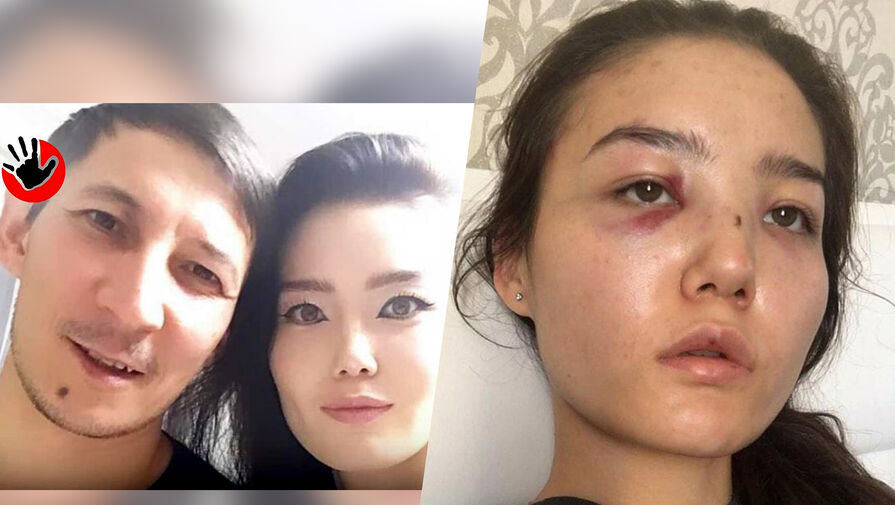 "Подвергаюсь насилию 10 лет": жена казахстанского дипломата обвинила мужа в избиениях