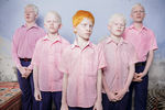 Брент Стиртон, ЮАР, занял первое место в категории «Портреты» с фотографией группы слепых мальчиков-альбиносов в интернате в Вивекананде, Западная Бенгалия