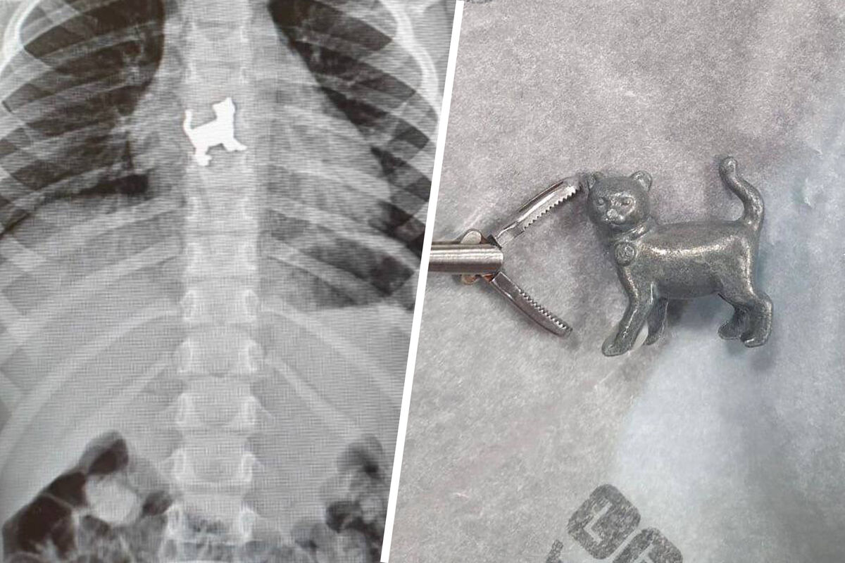Российские врачи спасли ребенка с металлической игрушкой в пищеводе -  Газета.Ru | Новости