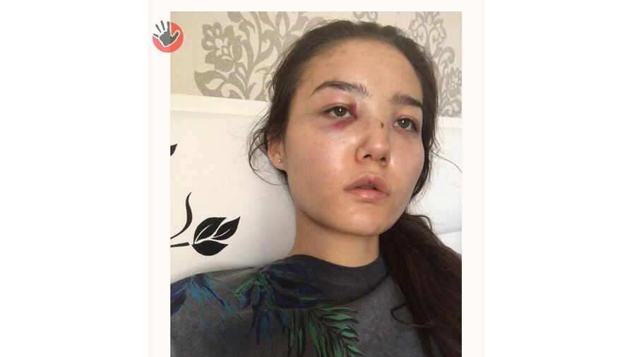 Жена сотрудника МИД Казахстана обвинила его в избиениях