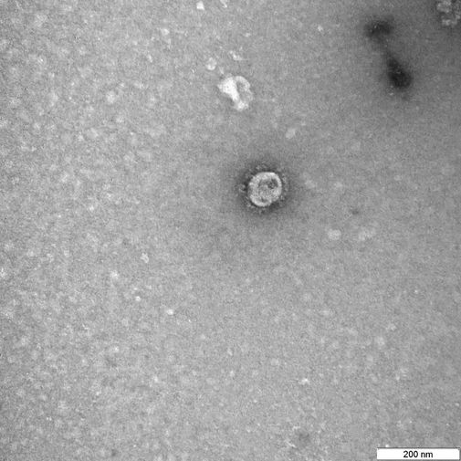 Снимки вируса COVID-19 через&nbsp;микроскоп в&nbsp;государственном научном центре вирусологии и биотехнологии &laquo;Вектор&raquo;