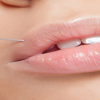 12 фактов, которые надо знать об увеличении губ