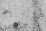Снимки вируса COVID-19 через микроскоп в государственном научном центре вирусологии и биотехнологии «Вектор»