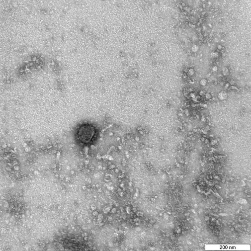 Снимки вируса COVID-19 через&nbsp;микроскоп в&nbsp;государственном научном центре вирусологии и биотехнологии &laquo;Вектор&raquo;