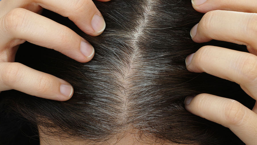 Почему рано седеют волосы у мужчин и у женщин — причины ранней седины