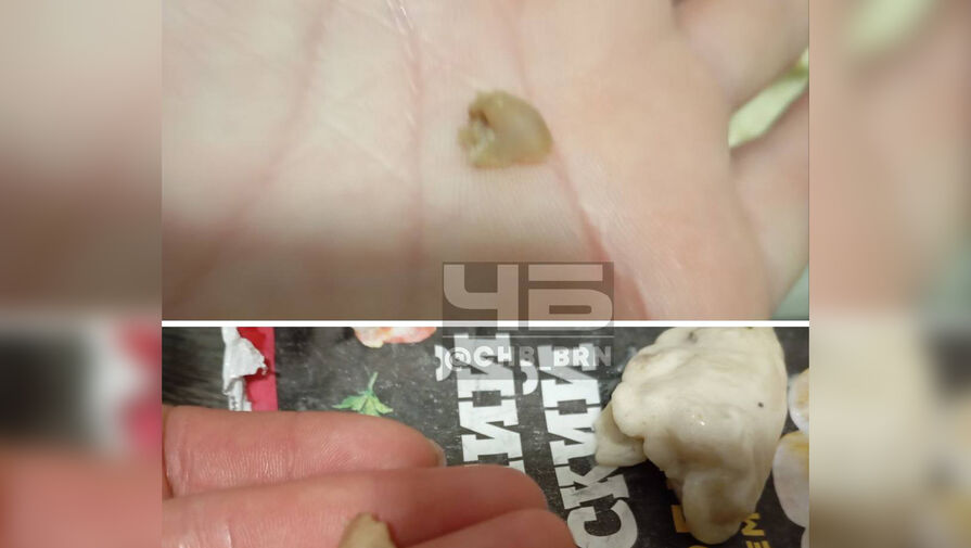 Россиянка нашла в варениках человеческий зуб