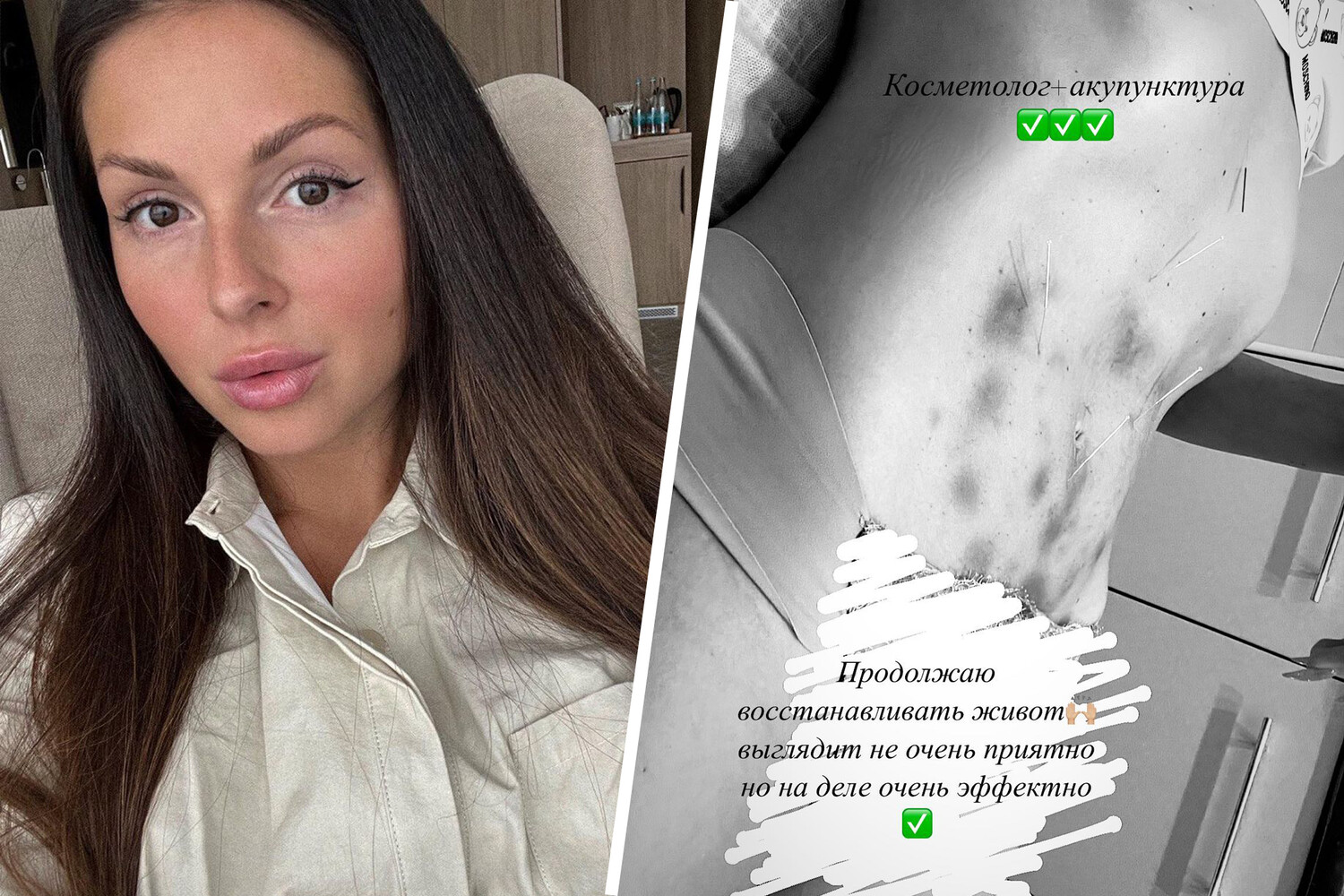 Фото не для слабонервных»: певица Нюша показала, как восстанавливает живот  после родов - Газета.Ru | Новости