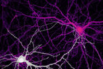 Связи между нейронами гиппокампа — клетки мозга