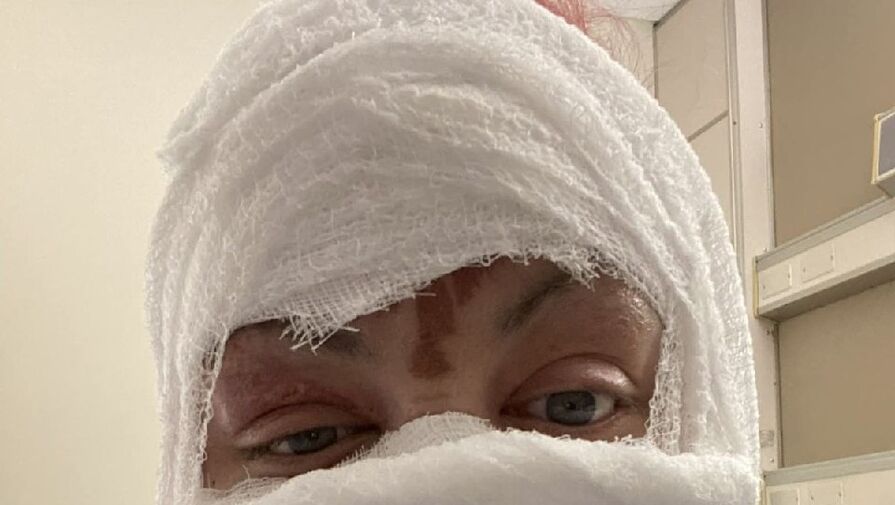 Женщина получила сильные ожоги лица во время ремонта автомобиля