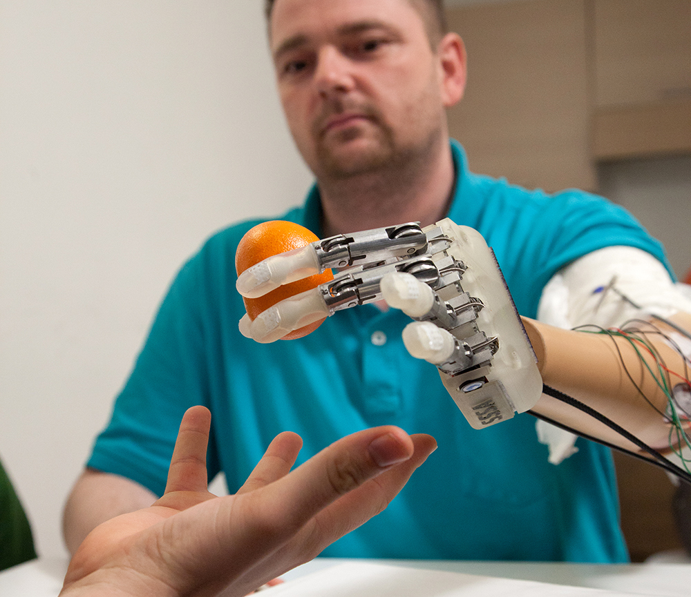 Молодой уральский ученый своими руками создал уникальный биомеханический протез