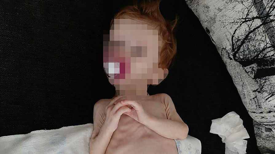 Младенца, которого прятали в шкафу в Карпинске, выпишут из реанимации