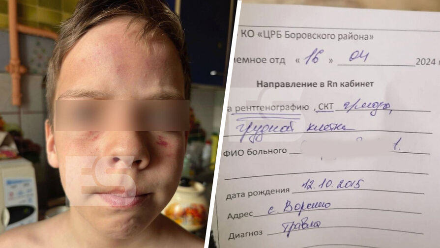 Двое россиян жестоко избили ребенка-инвалида с эпилепсией и собаку