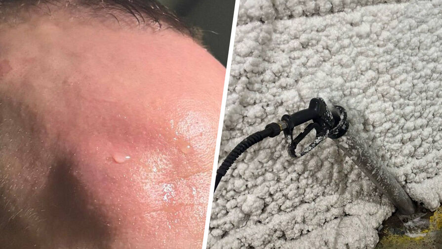 Пистолет высокого давления искалечил петербуржца на автомойке