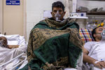 Пациенты получают кислород в Больнице святого семейства в Дели