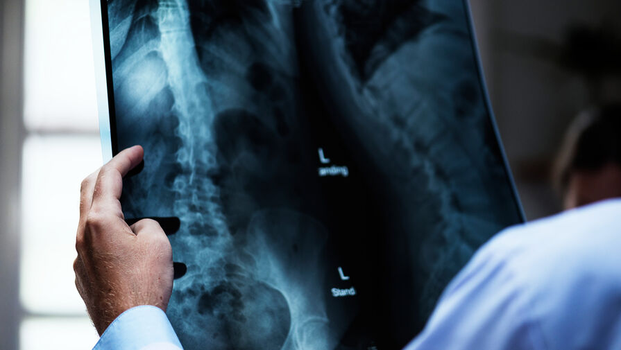 В 4 больницах Подмосковья заменили устаревшие рентген-аппараты