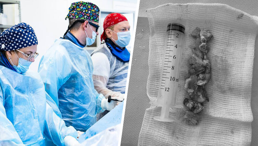 Подмосковные врачи спасли мужчину с гигантским флотирующим тромбом