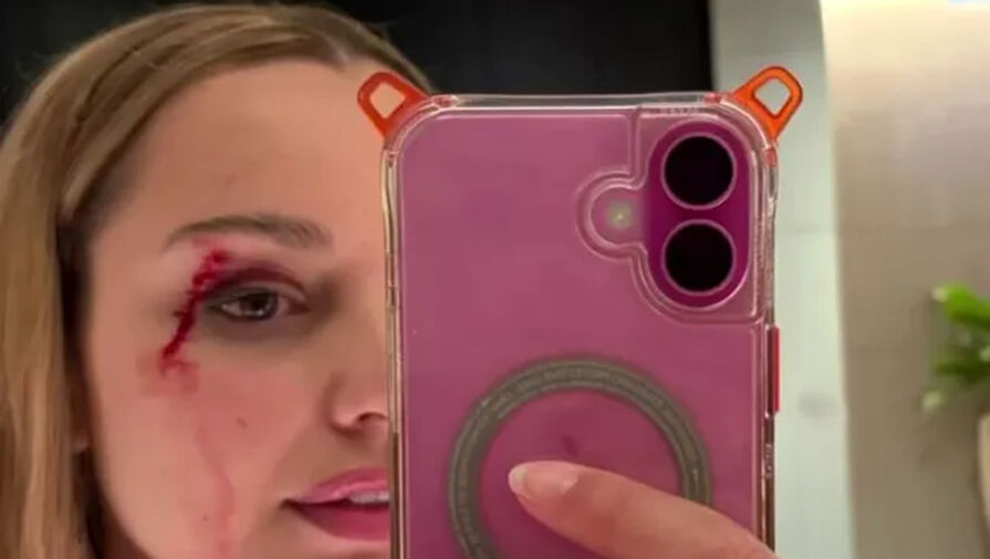 Птица атаковала журналистку и рассекла ей лицо во время съемок репортажа