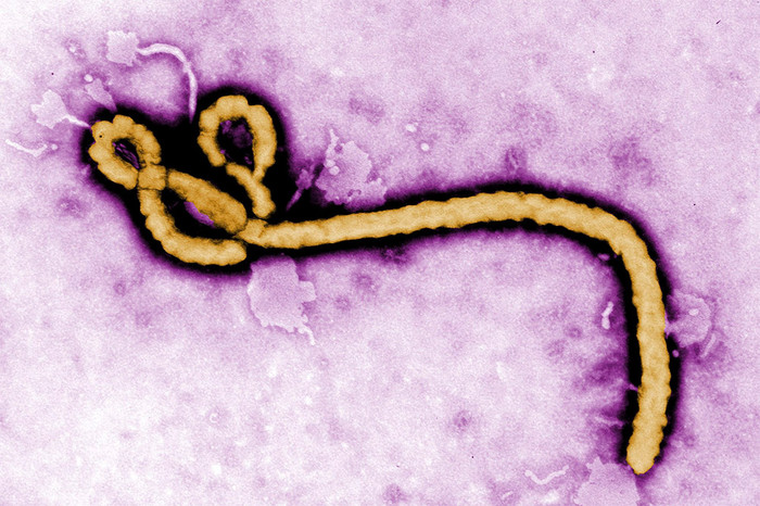 Снимок вириона Эболы, сделанный при&nbsp;помощи электронного микроскопа и впоследствии раскрашенный