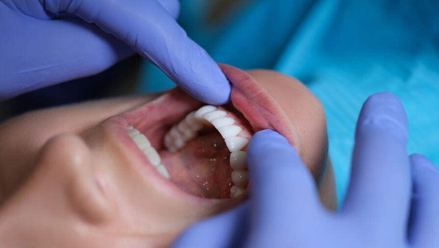 Стоматолог назвал популярную причину, по которой желтеют зубы