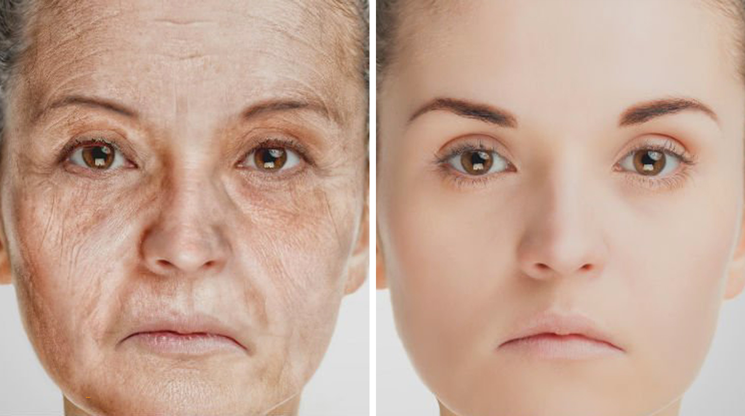 Возрастные изменения 40. Старение человека. Возрастные изменения кожи. Борьба со старением. Старение кожи.