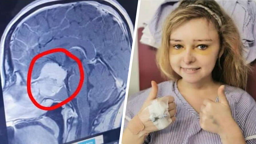 Британка пришла в больницу проверить зрение и узнала, что у нее в мозге опухоль