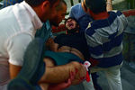 Раненый во время попытки переворота в Стамбуле