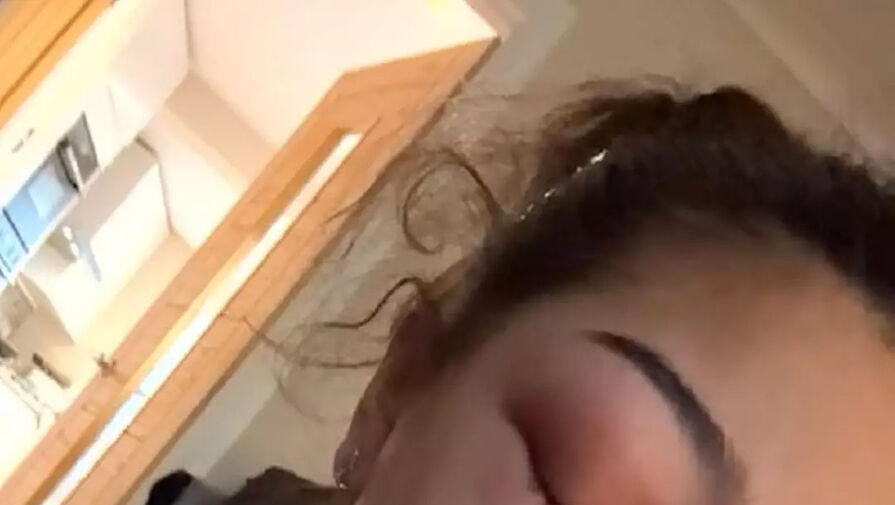 Женщина проснулась с распухшим глазом и попала в реанимацию из-за редкой инфекции