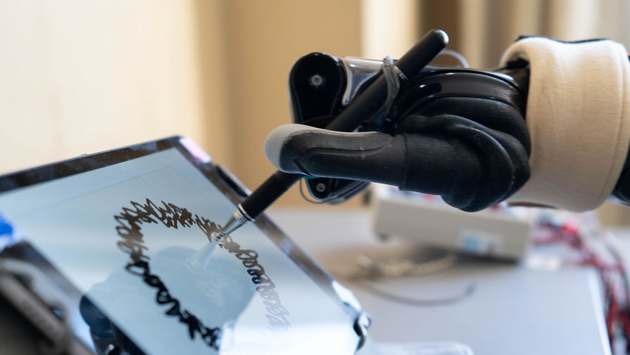 В России создали первый модуль локтя для бионических протезов