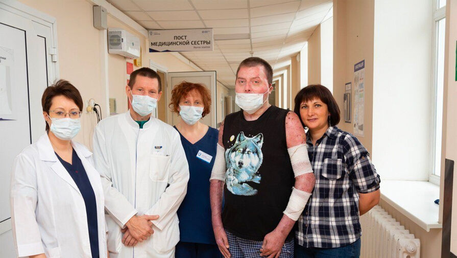 Российские врачи спасли мужчину с ожогом 90% тела