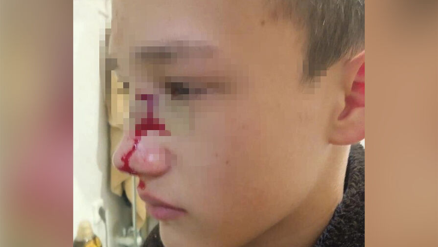 Под Новосибирском подростки жестоко избили 14-летнего одноклассника