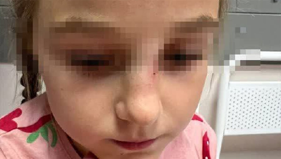В Подмосковье женщина сломала нос 7-летней девочке, ударив ее головой о карусель