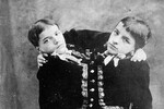 <b>Джованни и Джакомо Токки</b>
<br><br>
Джованни и Джакомо Токки родились между 1875 и 1877 годами в Италии. Близнецы были дицефалами, то есть имели одно туловище и две головы, а также две пары рук. Уже в раннем возрасте они начали выступать в цирке, их родители при этом не разрешали врачам обследовать мальчиков, боясь, что это умалит их славу. В 1891 году они отправились в США на гастроли, которые в итоге вылились в пятилетнее турне из-за популярности братьев. Именно в этот период их фотография попалась Марку Твену, и, вдохновившись снимком, он создал рассказ «Эти необыкновенные близнецы» (1892), который позже стал романом «Простофиля Уилсон» (1894). В 1897 году Джованни и Джакомо решили уйти на пенсию и стали вести затворническую жизнь на вилле в Венеции. В 1904-м братья женились на двух женщинах. По некоторым данным, позже они также завели детей. Однако другие сообщения утверждали, что близнецы умерли бездетными в 1940-м.
<br><br>
<b>На фото:</b> братья Точчи на визитной карточке, 1880-е гг.