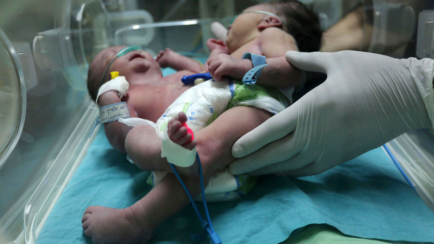 Младенец о двух головах: кто родился на Украине