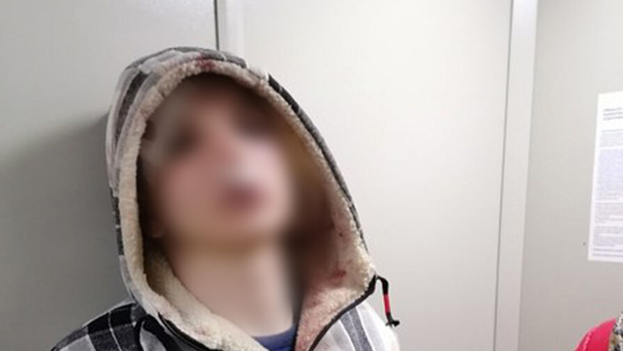 Мать избитого подростка из Люберец, который пытался заступиться за продавца, рассказала подробности нападения