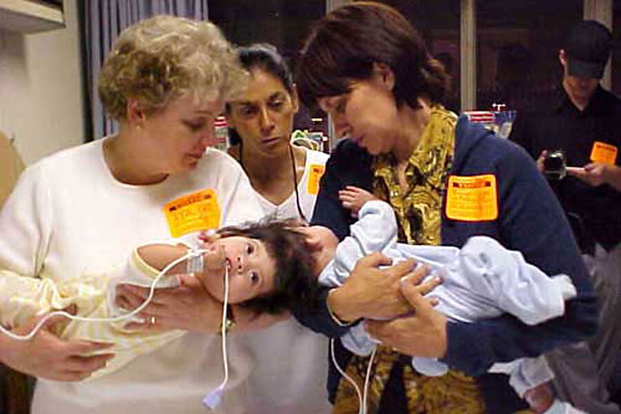 <b>Мария-де-Хесус и Мария-Тереза Киех-Альварес</b>
<br><br>
Мария-де-Хесус и Мария-Тереза Киех-Альварес родились в&nbsp;2001 году в&nbsp;Гватемале. Они были соединены черепами с&nbsp;раздельными туловищами (краниопаги), часть тканей головного мозга были общими. Спустя 17&nbsp;месяцев после рождения сестры перенесли уникальную 22-часовую операцию по&nbsp;разделению при&nbsp;Калифорнийском университете Лос-Анджелеса. После операции девочки росли в&nbsp;приемных семьях.
<br><br>
<b>На фото:</b> Сотрудники медицинского центра Калифорнийского университета держат на&nbsp;руках 11-месячных сестер из&nbsp;Гватемалы, Марию Терезу и Марию де Хесус Киех-Альварес, 2002&nbsp;год