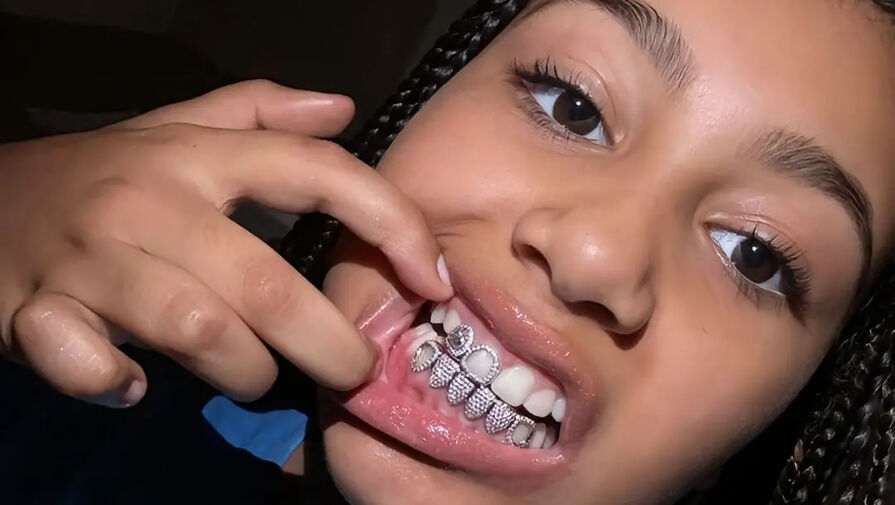 Дочь Уэста и Кардашьян Норт установила на зубы бриллиантовые гриллзы 