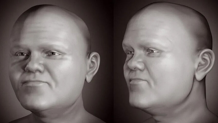 Воссоздано лицо средневекового мужчины из Польши, страдавшего от двух форм карликовости