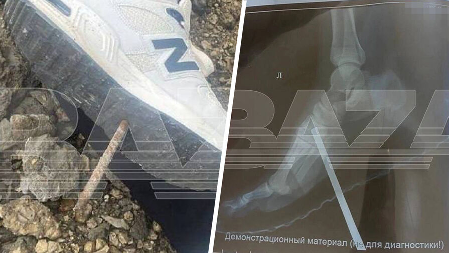 Россиянин проткнул ногу штырем насквозь, когда сходил с поезда