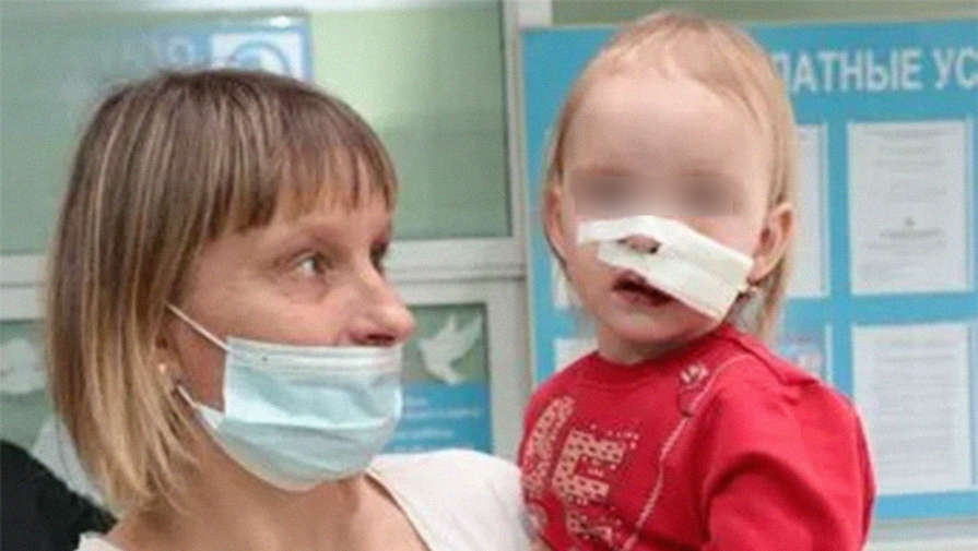 Бродячая собака прокусила лицо двухлетней девочке, когда она ела чипсы