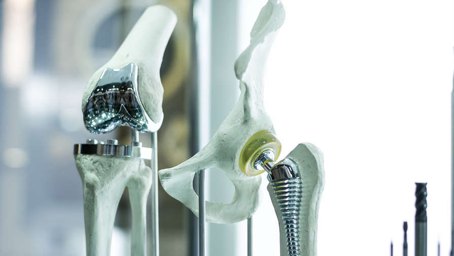 Российские ученые создали имплант, полностью восстанавливающий кость