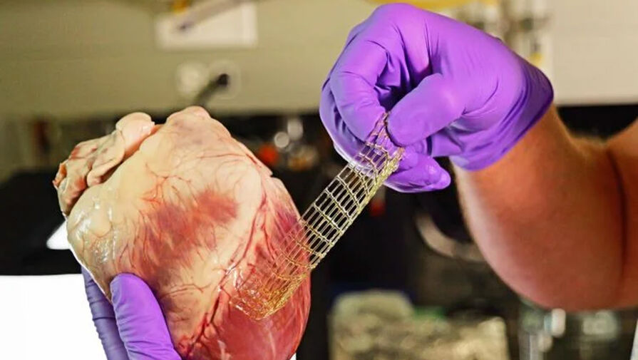 Дождевые черви вдохновили ученых на создание гибкого пластыря для сердца