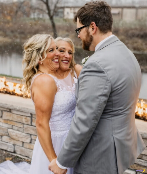 <b>Эбигейл и Бриттани Хенсел</b>
<br><br>
Сестры Эбигейл и Бриттани Хенсел &mdash; сиамские близнецы-дицефалы из&nbsp;США. Девочки родились в&nbsp;1990 году, отучились в&nbsp;школе и закончили университет, после чего начали преподавать в&nbsp;школе каждая свой предмет. В&nbsp;2021 году Эбигейл вышла замуж за&nbsp;медбрата Джошуа Боулинга. В&nbsp;2025 году сестры, которые имеют общую репродуктивную систему, стали мамами.
<br><br>
<b>На фото:</b> Эбигейл и Бриттани Хенсел во время свадьбы Эбигейл и ветерана армии США Джоша Боулинга, 2021&nbsp;год