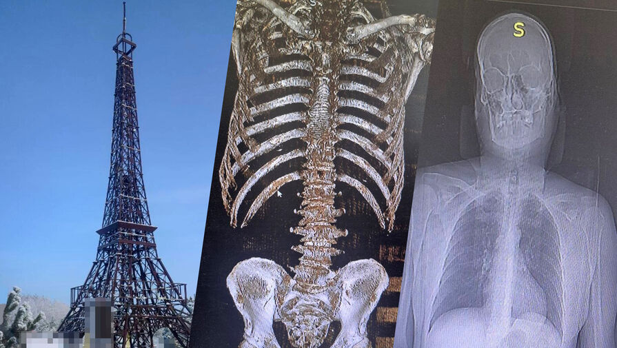 Мужчина сломал ребра, упав с Эйфелевой башни в российском регионе