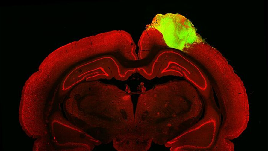 Биологи исправили повреждения в мозге крысы с помощью заплатки из человеческих нейронов