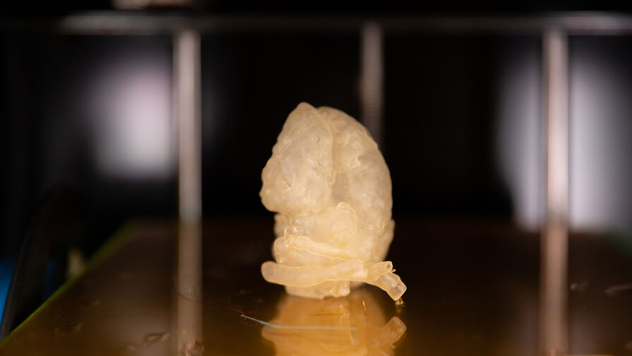 Новая технология позволяет за 20 секунд создать 3D-модель сердца пациента перед операцией
