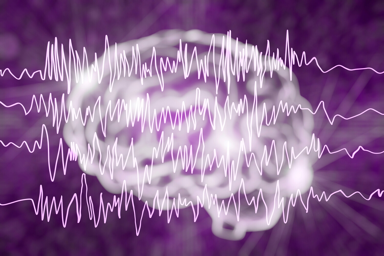 Эпилепсия 2023. День эпилепсии. Международный день эпилепсии. День эпилепсии фиолетовый день. Фиолетовый день больных эпилепсией.